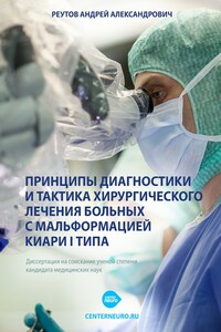 Принципы диагностики и тактика хирургического лечения больных с мальформацией Киари I типа